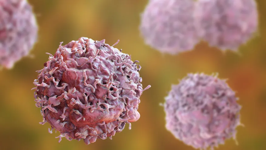 Cancer deaths among men expected to rise 94 percent worldwide by 2050: Study