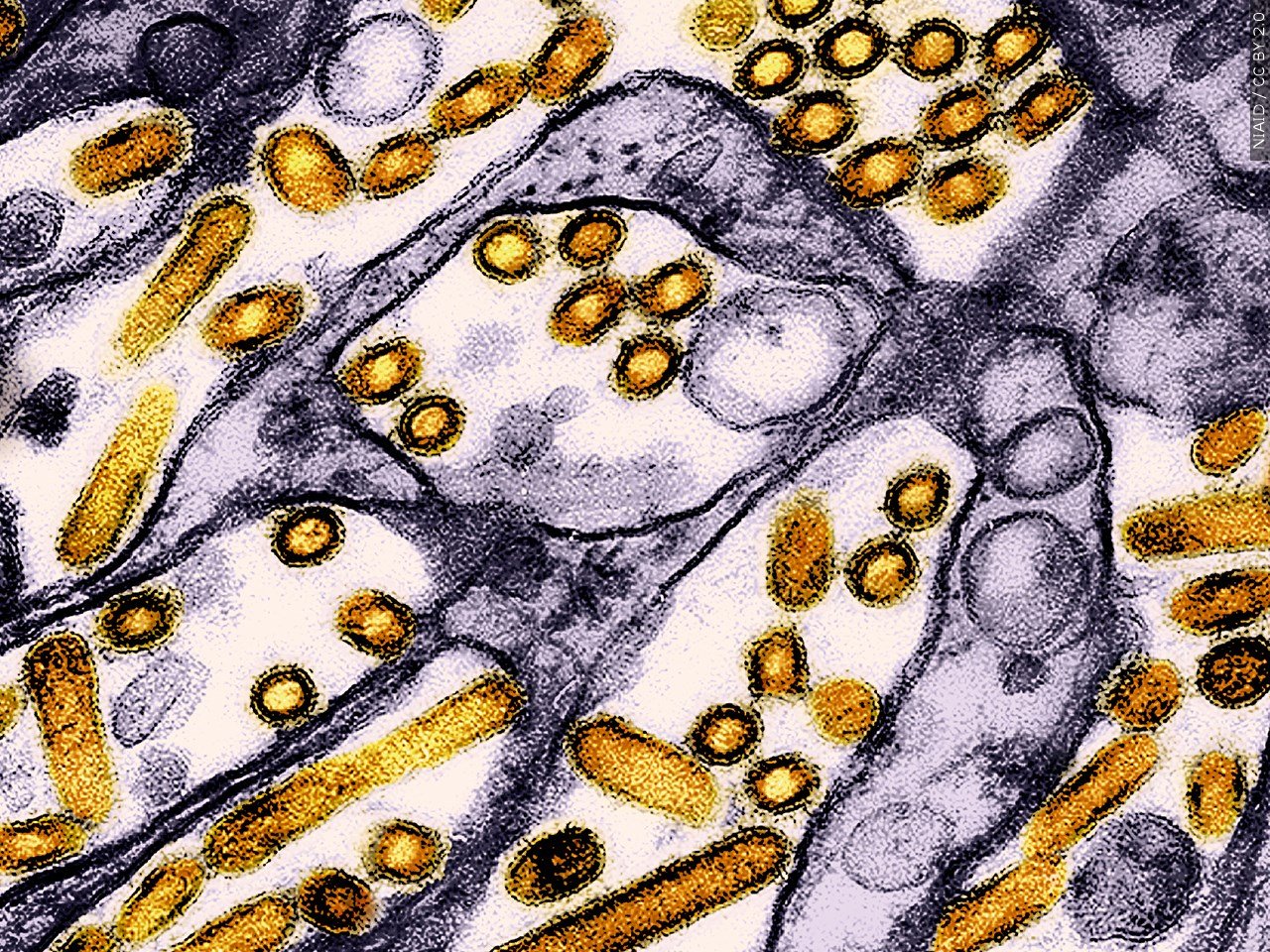 CDC confirms 1st case of severe bird flu in US