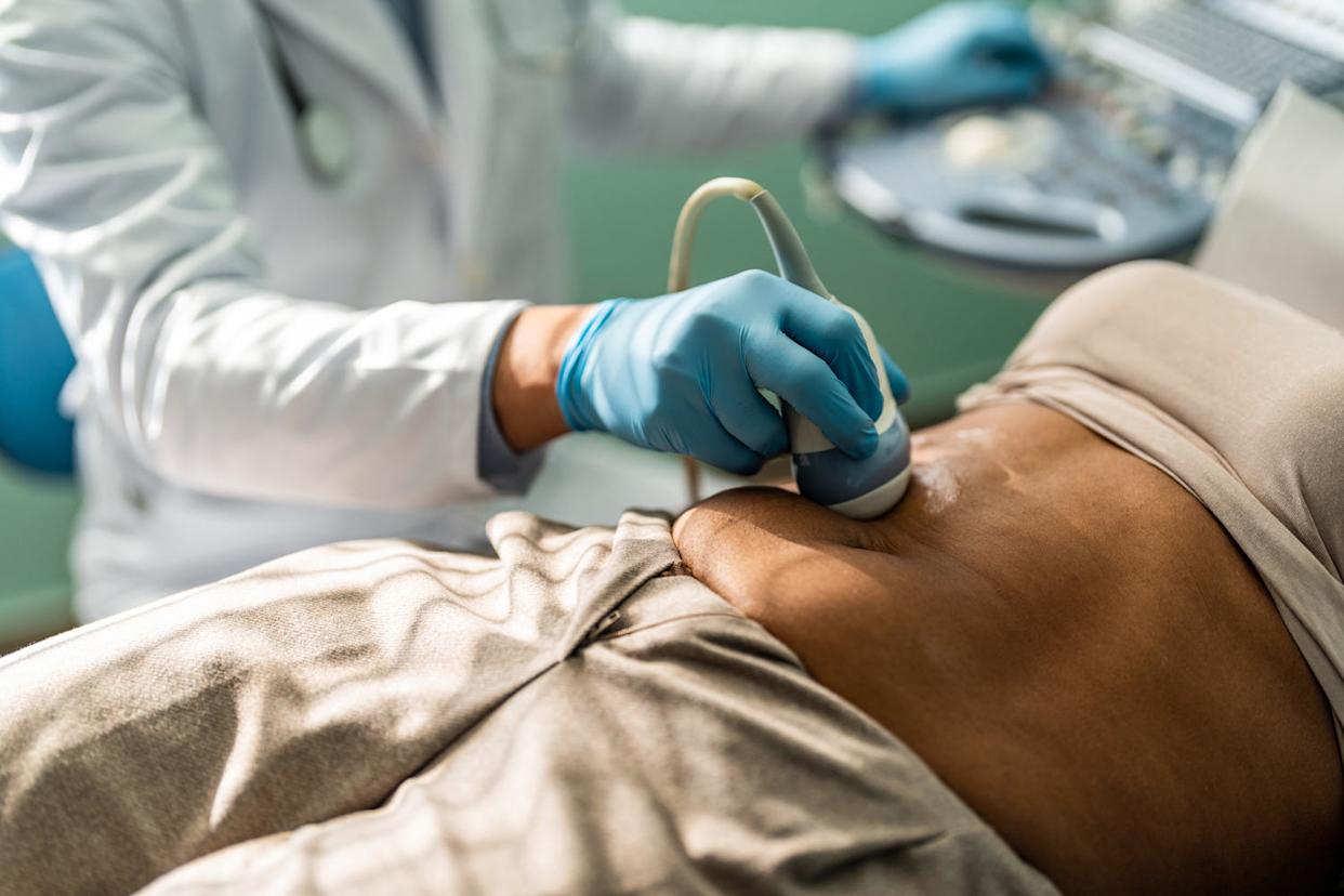 Appendix cancers on the rise in younger generations, study finds