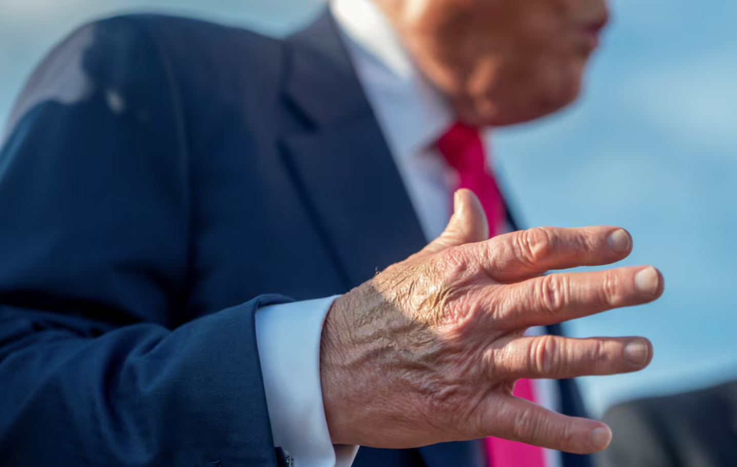 Trump diagnosed with vein condition causing leg swelling, White House says