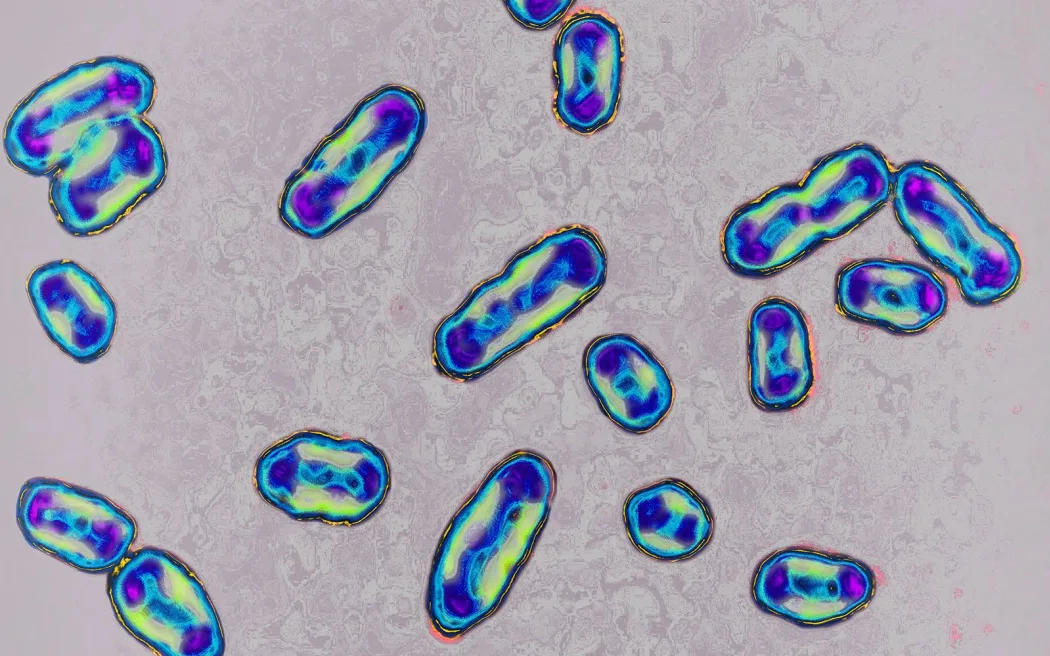 California resident tests positive for plague