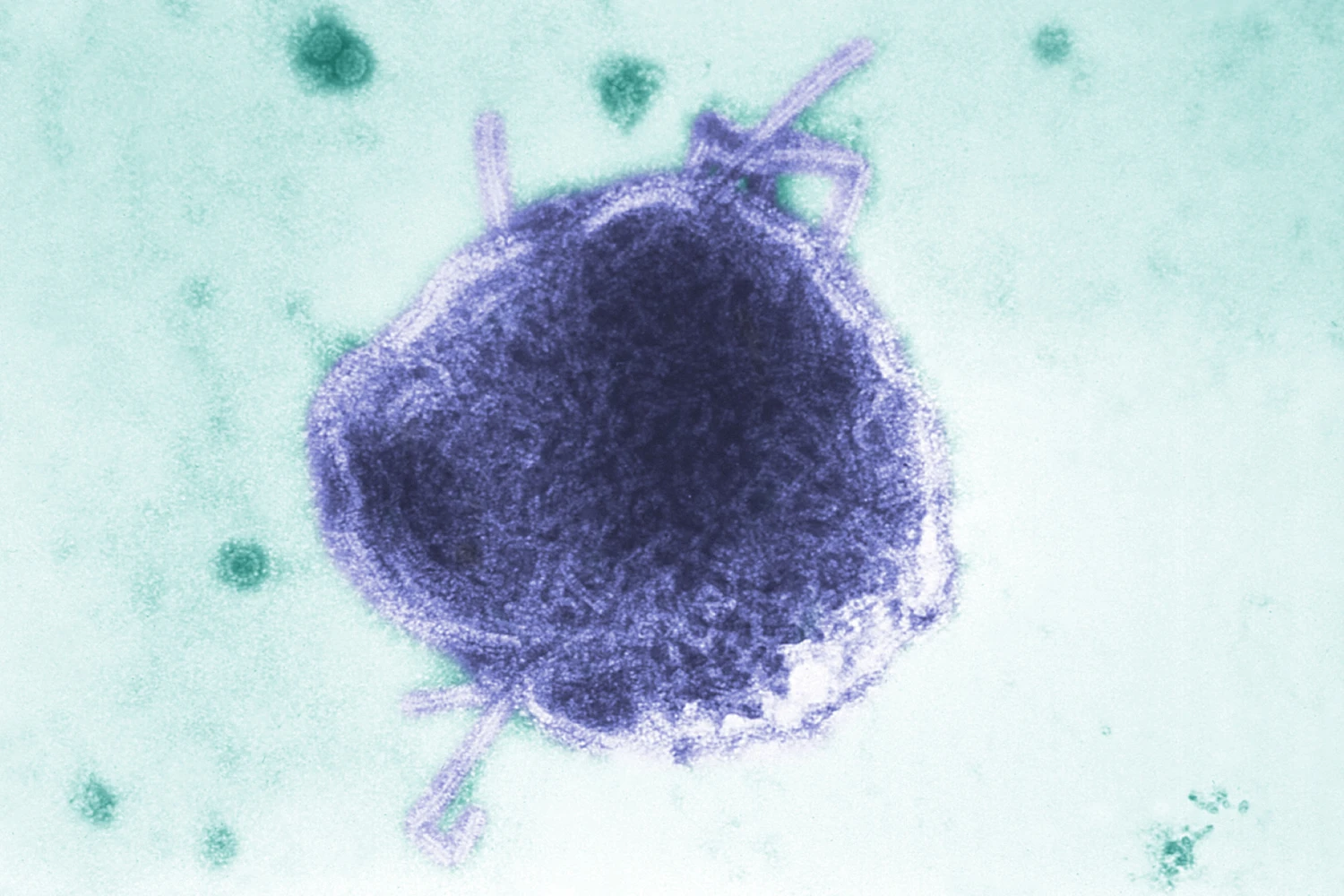 Los Angeles child dies from rare measles complication years after recovery