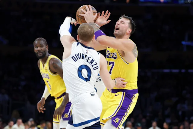 Lakers’ Luka Doncic likely out at least one week with sprained finger, bruised leg