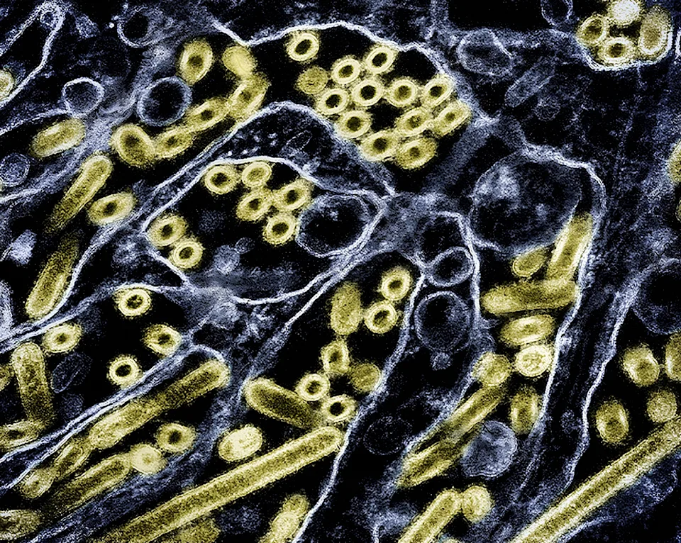 1st human known to be infected with H5N5 strain of bird flu dies, Washington state officials say